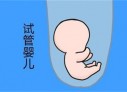 培养惠州捐卵宝宝艺术细胞的小技巧